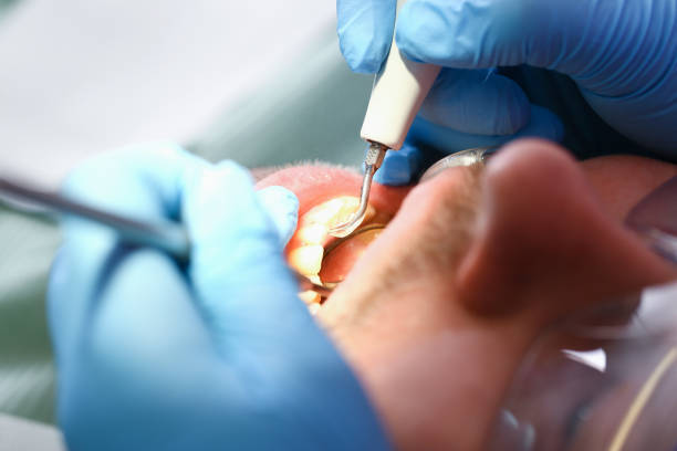 Best After-Hours Emergency Dentist in Jonesville, MI